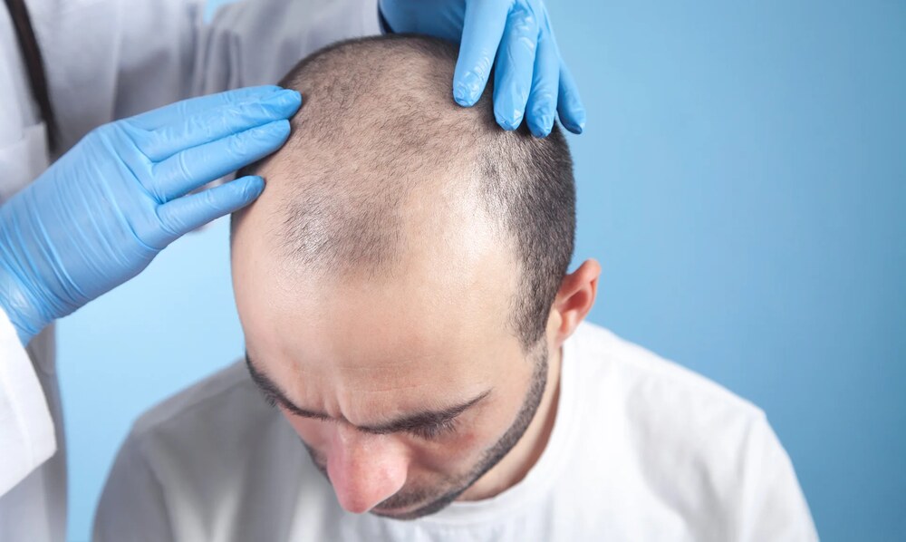 Scalp Biopsy
