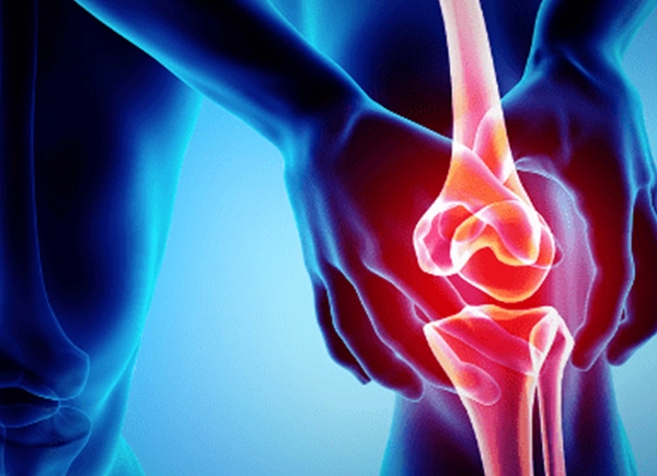 Knee Joint Injury